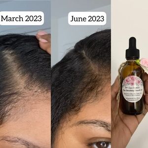 Hair Growth Oil